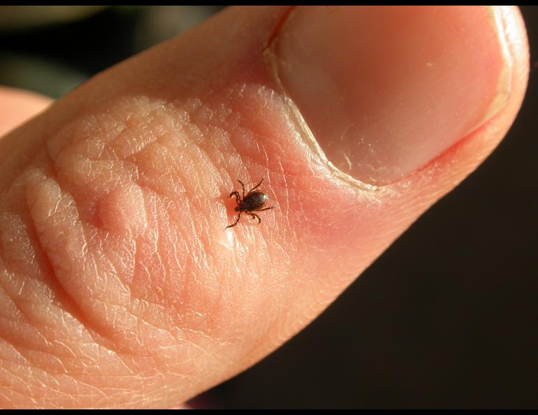 Tick on a human thumb. 