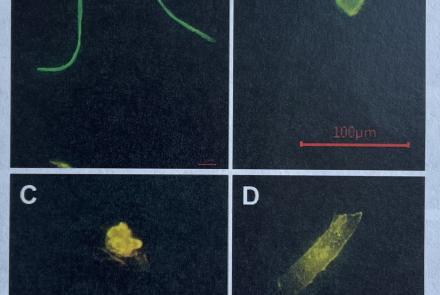 Magnified 400 times, four types of microplastics found by Subhabrata Dev, Srijan Aggarwal, and others during a study in Alaska. A is a plastic fiber, B a fragment, C a pellet, and D a film. From the paper Unveiling Microplastics Pollution in Alaskan Waters and Snow.